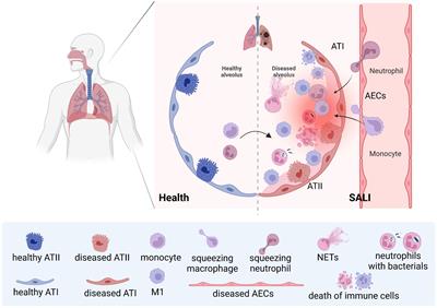 The role of macrophages polarization in sepsis-induced acute lung injury